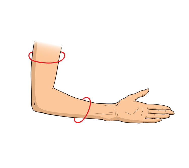 Dekubitusprophylaxe Ellenbogen